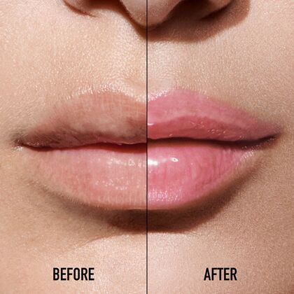 Lippenbalsam