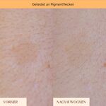 5 ML JUNGLÜCK JUNG PFLEGE GESICHT Pigmentflecken & Pickelmale Roll-On  7 of 7 Pigmentflecken & Pickelmale Roll-On