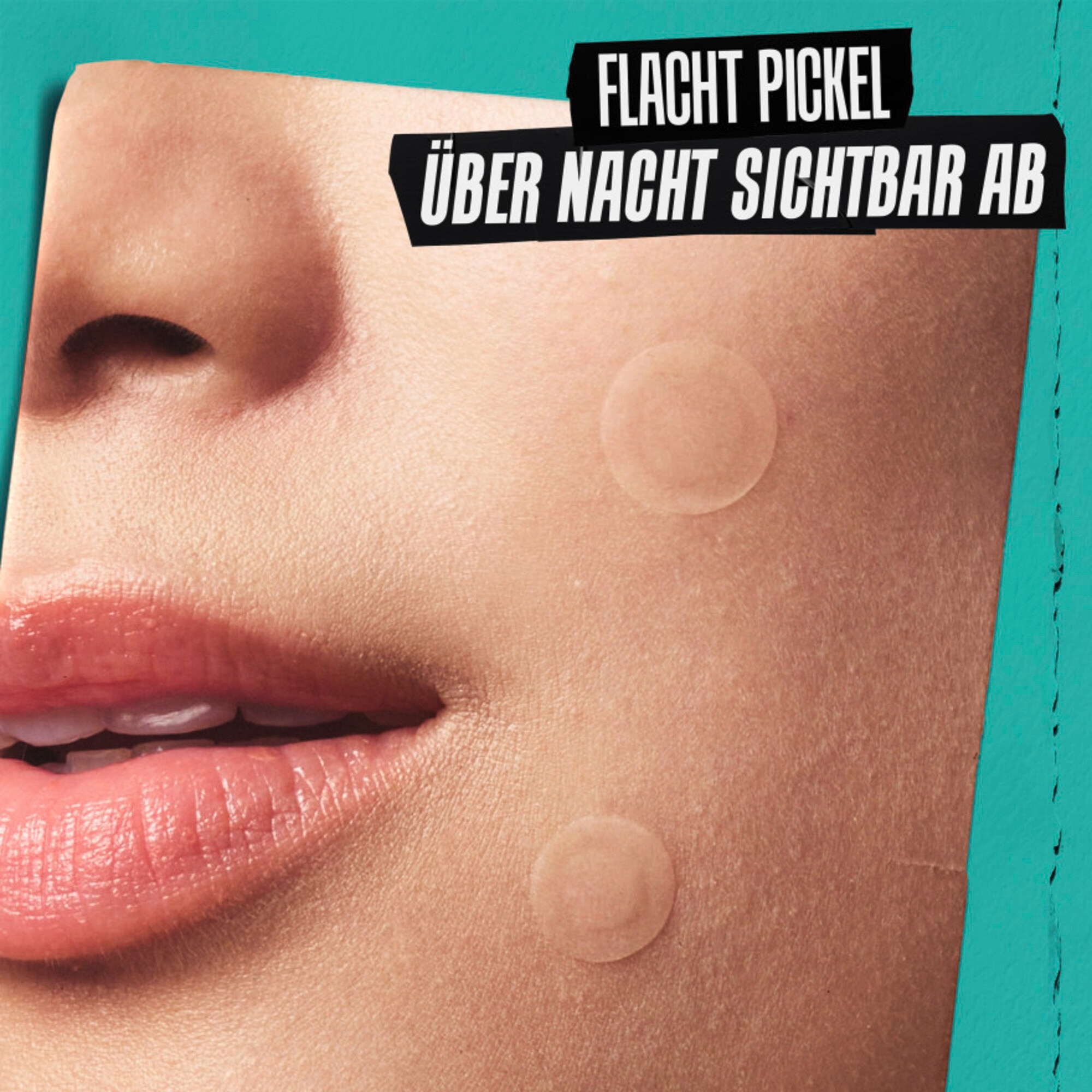 22 Stück/e Kiehl's Truly Targeted Overnight Blemish Patches Gesichtspflege 2 of 7 Gesichtspflege