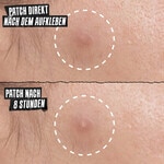 22 Stück/e Kiehl's Truly Targeted Overnight Blemish Patches Gesichtspflege 4 of 7 Gesichtspflege