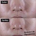 50 ML Kiehl's Ultra Facial Oil-Free Gel-Cream Gesichtscreme  4 of 7 Gesichtscreme