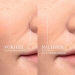 20 ML Lancôme RÉNERGIE Gesichtsserum  4 of 6 Gesichtsserum
