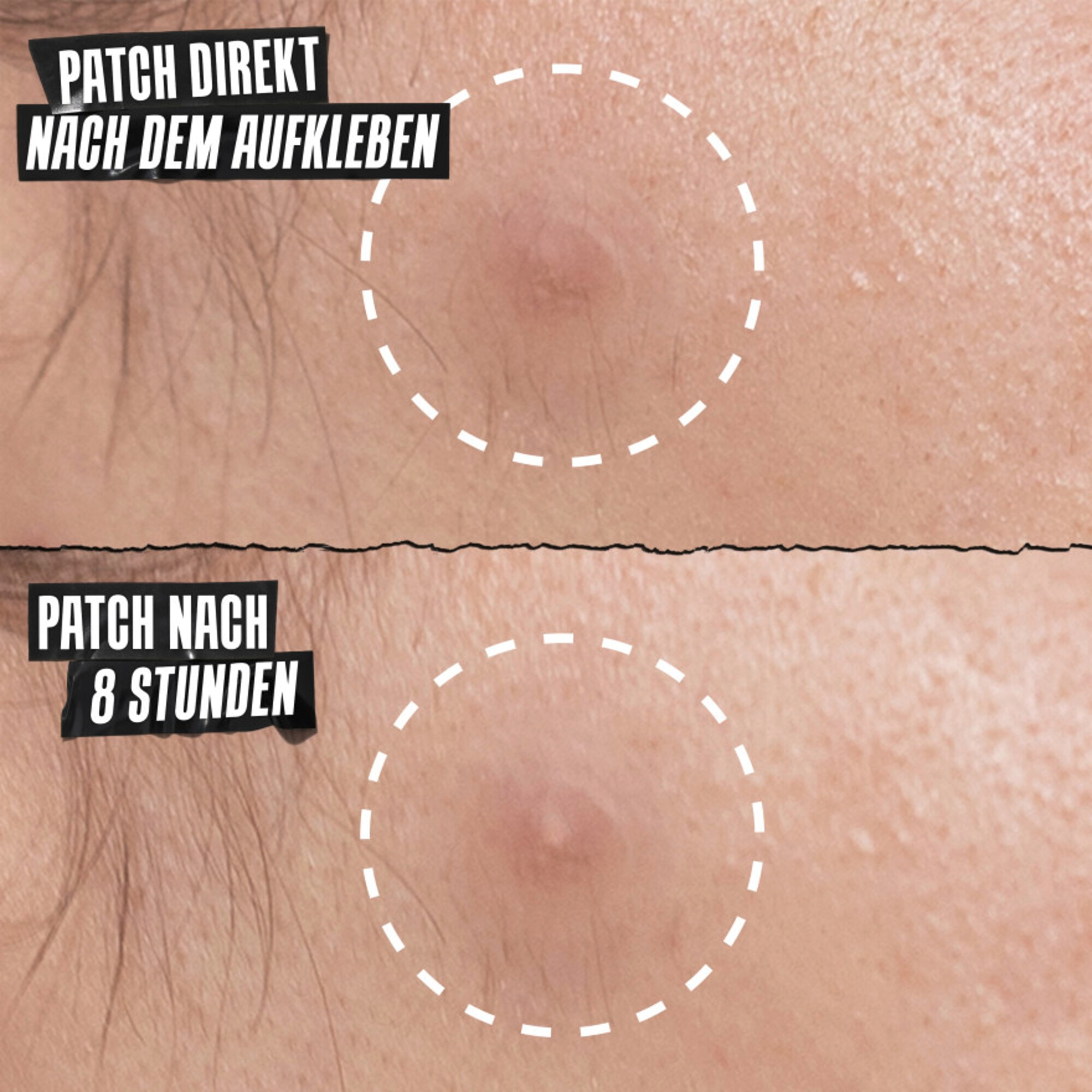 22 Stück/e Kiehl's Truly Targeted Overnight Blemish Patches Gesichtspflege 4 of 7 Gesichtspflege