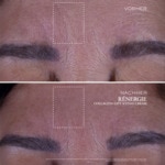 50 ML Lancôme RÉNERGIE Gesichtscreme 3 of 7 Gesichtscreme