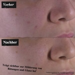 500 ML Kiehl's Calendula Herbal Extract Toner Gesichtsreinigung  4 of 8 Gesichtsreinigung